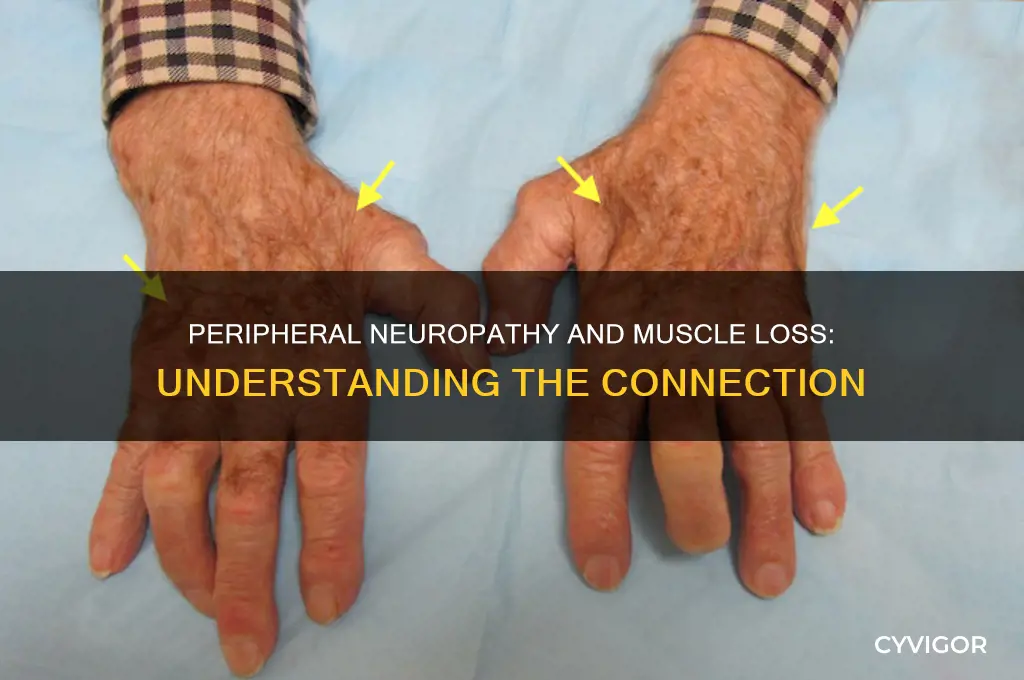 can peripheral neuropathy cause muscle loss