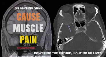 Pheochromocytoma and Muscle Pain: Unraveling the Hidden Connection
