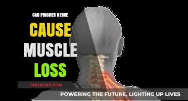 Pinched Nerve and Muscle Loss: Understanding the Connection and Risks