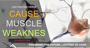 Pinched Nerve: Muscle Weakness and How to Treat It