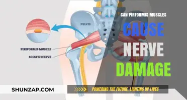 Piriformis Syndrome and Sciatic Nerve Damage: Unraveling the Connection
