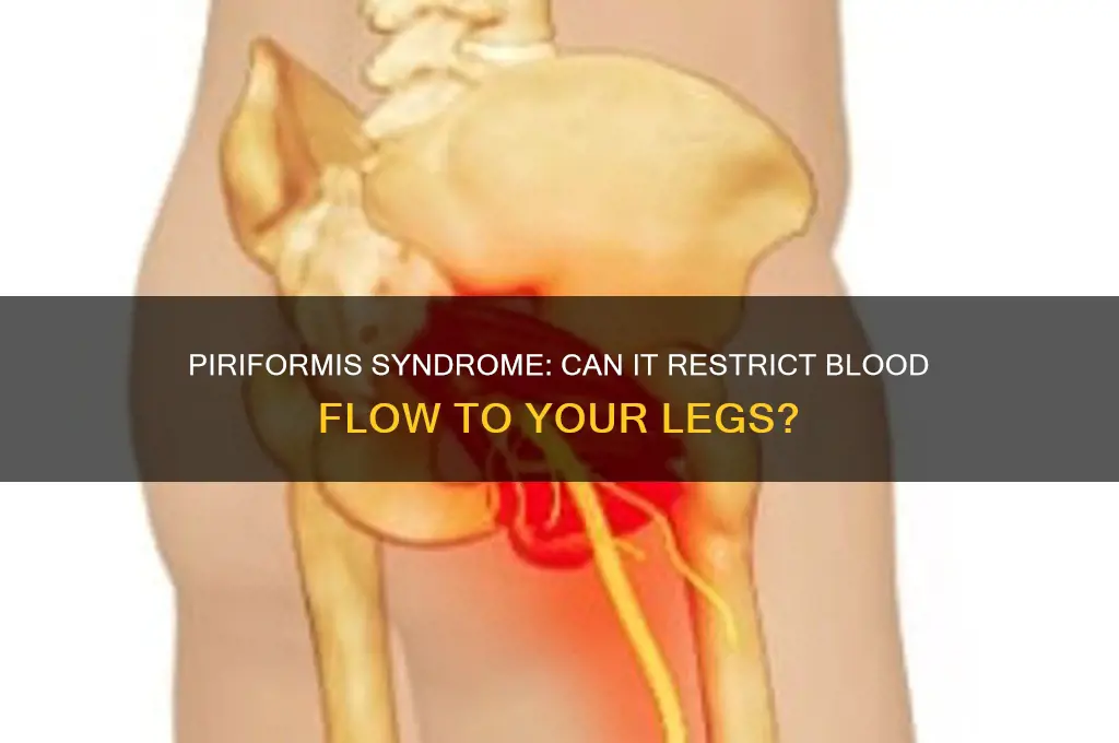 can piriformis muscle cause blood flow to legs be impeded