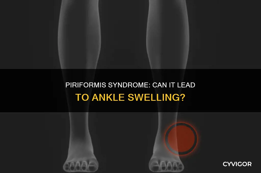 can piriformis muscle cause swelling in ankles