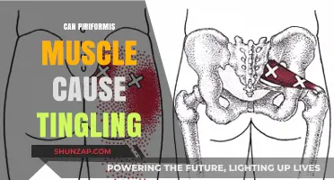 Piriformis Muscle and Tingling: Unraveling the Sciatic Nerve Connection
