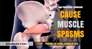 Piriformis Syndrome and Muscle Spasms: Understanding the Connection