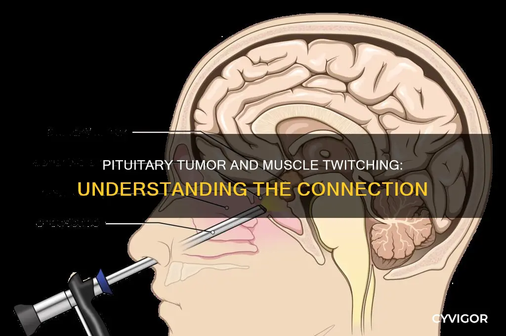 can pituitary tumor cause muscle twitching