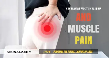 Can Plantar Fasciitis Trigger Hip and Muscle Pain? Exploring the Link