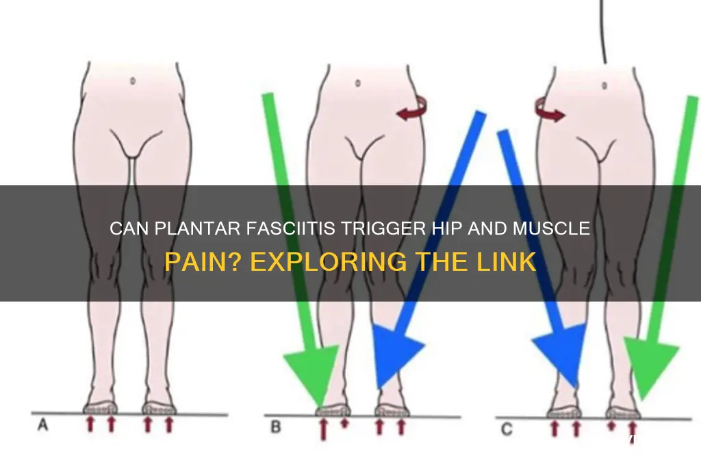 can plantar fascitis cause hip and muscle pain