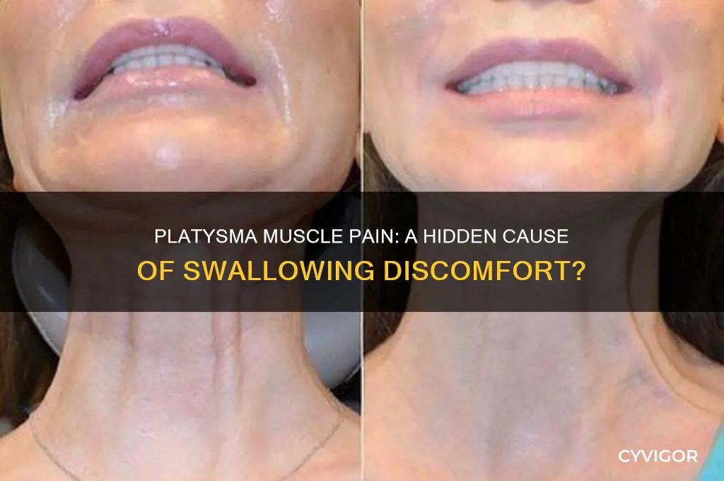 can platysma muscle pain cause pain in swallowing