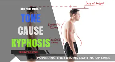 Can Weak Muscles Lead to Kyphosis? Understanding the Connection