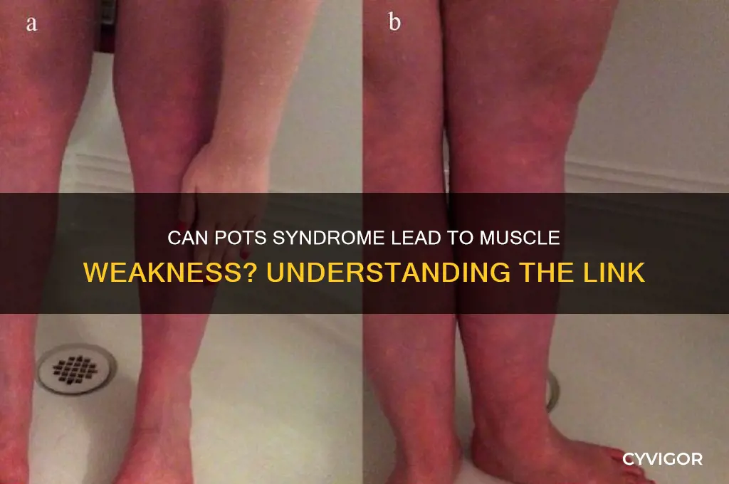 can pots cause muscle weakness