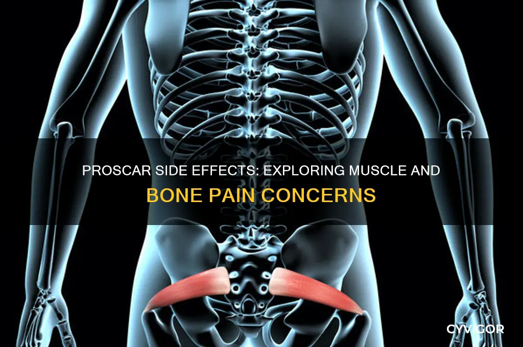 can proscar cause muscle and bone pain