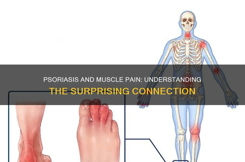 can psoriasis cause muscle pain