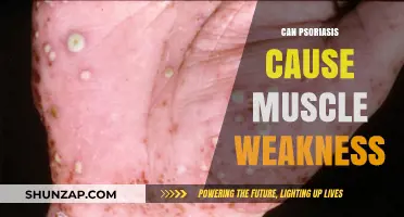 Psoriasis and Muscle Weakness: Understanding the Potential Connection