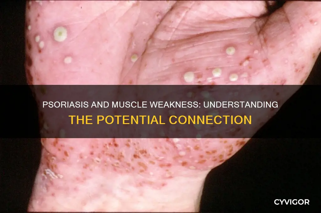 can psoriasis cause muscle weakness