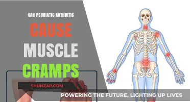 Psoriatic Arthritis and Muscle Cramps: Understanding the Connection