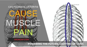 Psoriatic Arthritis: Muscle Pain and Its Connection