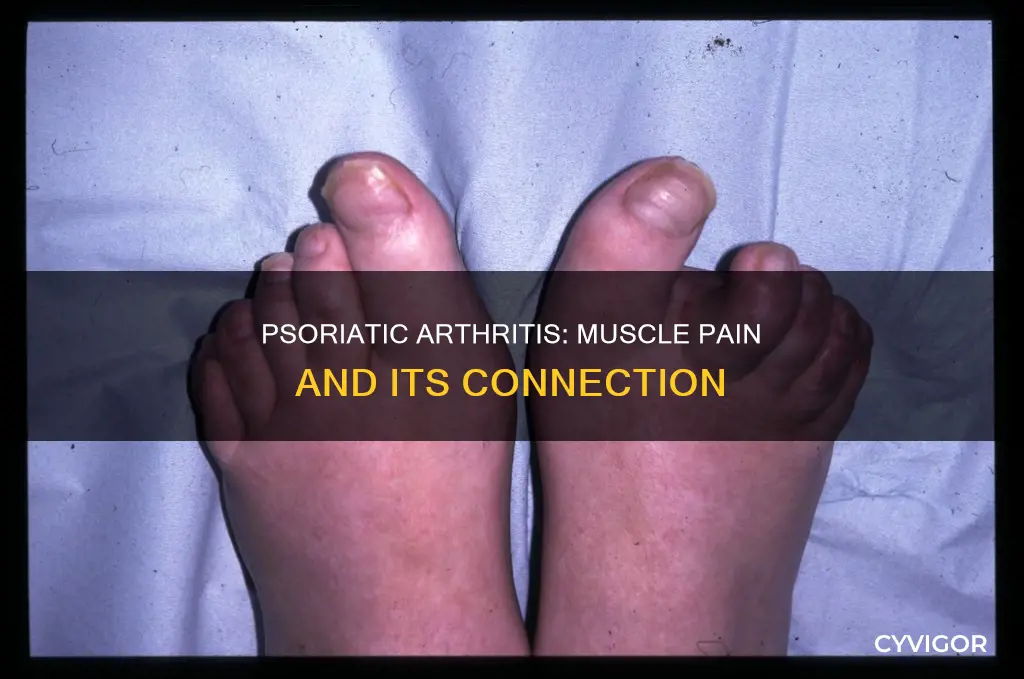 can psoriatic arthritis cause muscle pain
