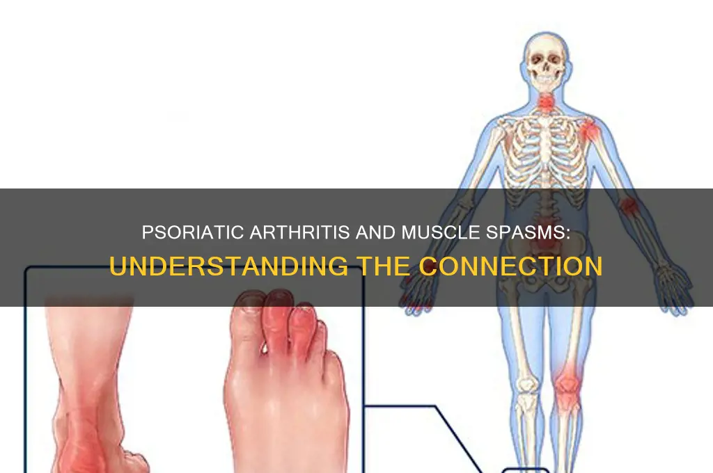 can psoriatic arthritis cause muscle spasms