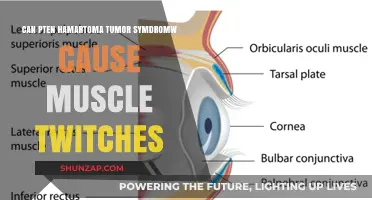PTEN Hamartoma Tumor Syndrome: Exploring Its Link to Muscle Twitches