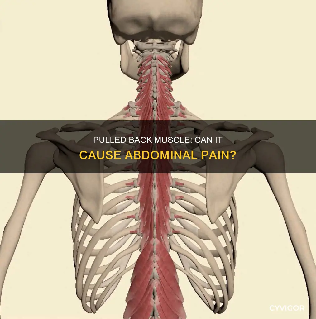 can pulled back muscle cause abdominal pain