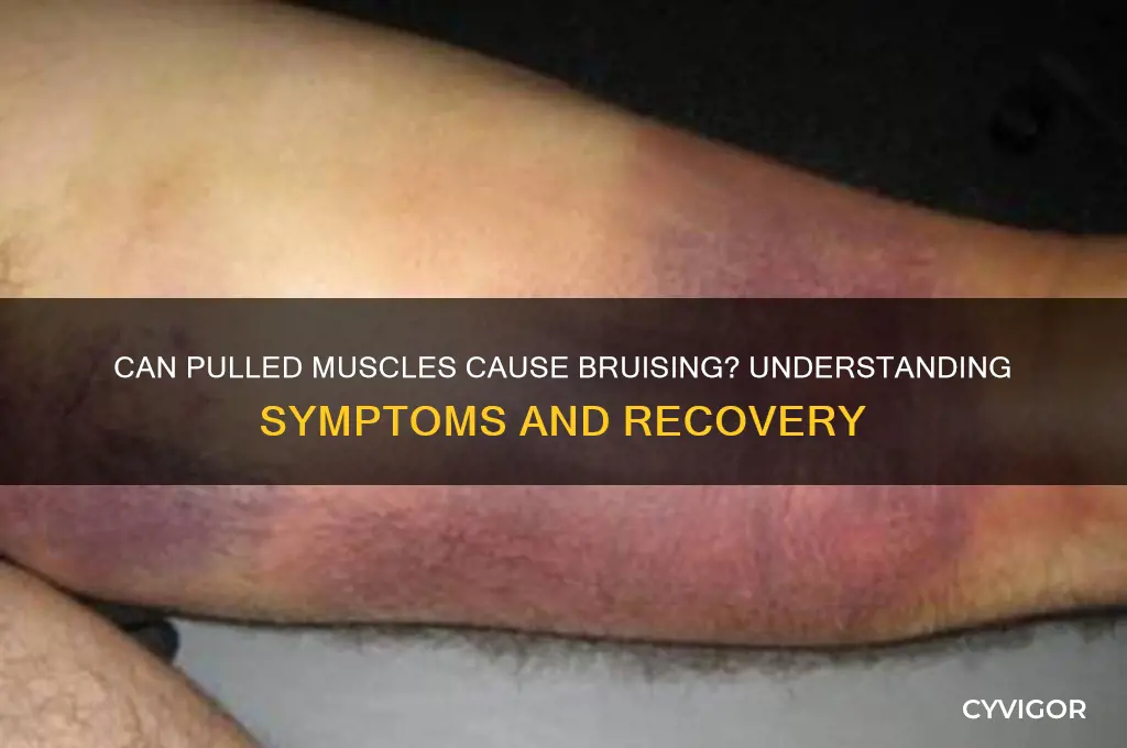 can pulled muscle cause bruising