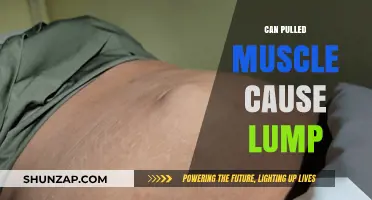Can a Pulled Muscle Cause a Lump? Understanding Symptoms and Causes