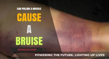 Can Muscle Pulls Lead to Bruising? Understanding the Connection