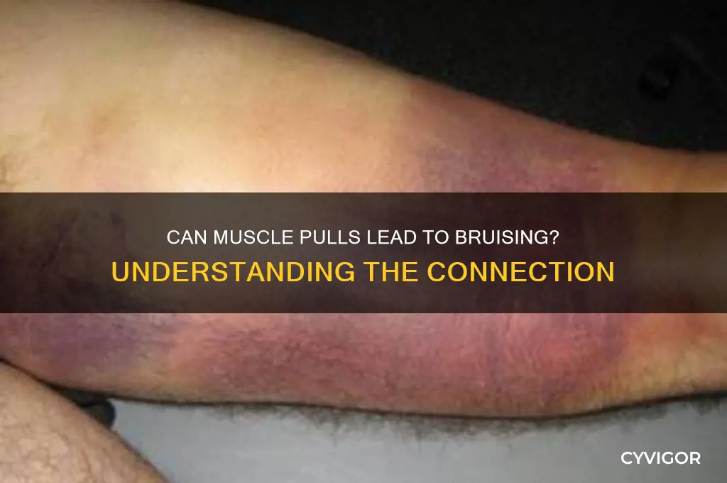 can pulling a muscle cause a bruise
