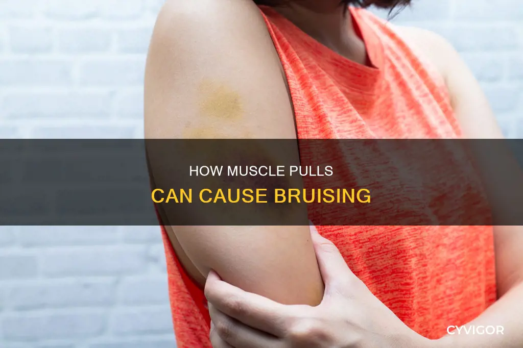 can pulling a muscle cause bruising