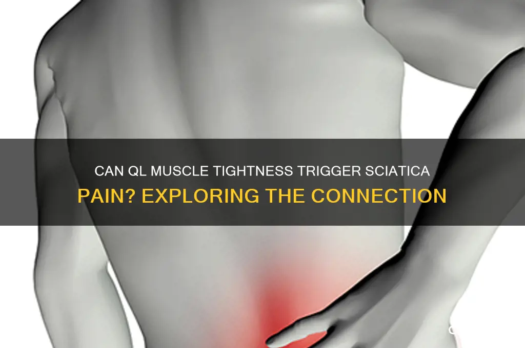 can ql muscle cause sciatica
