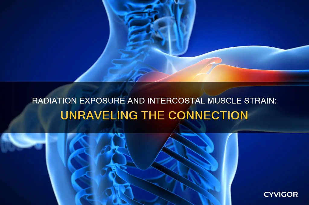 can radiation cause intercostal muscle strain