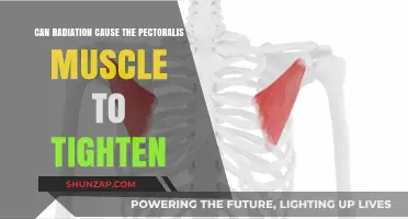 Radiation-Induced Pectoralis Muscle Tightness: Causes, Symptoms, and Relief