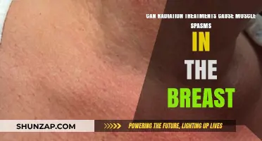 Radiation Therapy and Breast Muscle Spasms: Uncovering the Connection