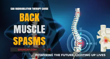 Radioablation Therapy and Back Muscle Spasms: Exploring Potential Side Effects