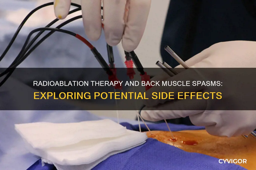 can radioablation therapy cause back muscle spasms