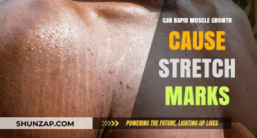 Rapid Muscle Growth and Stretch Marks: What's the Connection?