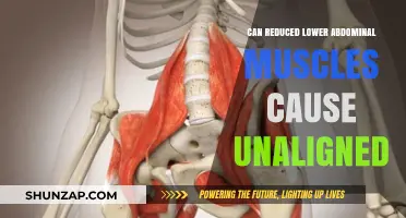 Weak Lower Abdominal Muscles: A Hidden Cause of Postural Misalignment?