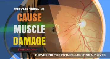 Retinal Tear Repair: Potential Risks and Muscle Damage Concerns