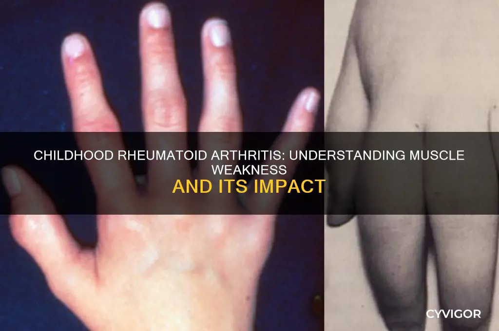 can rhematoud srthritis in children cause muscle weakness