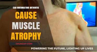 Rheumatoid Arthritis and Muscle Atrophy: Understanding the Connection