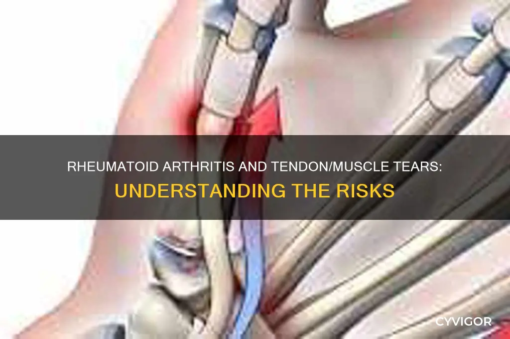 can rheumatoid arthritis cause u to tear tensons and muscles