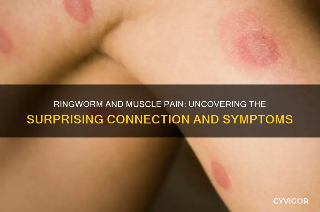 can ringworm cause muscle pain