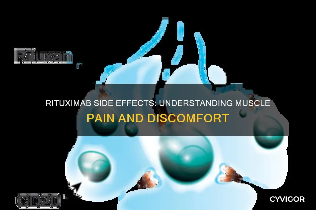 can rituximab cause muscle pain