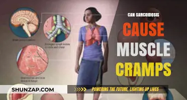 Sarcoidosis and Muscle Cramps: Understanding the Potential Connection