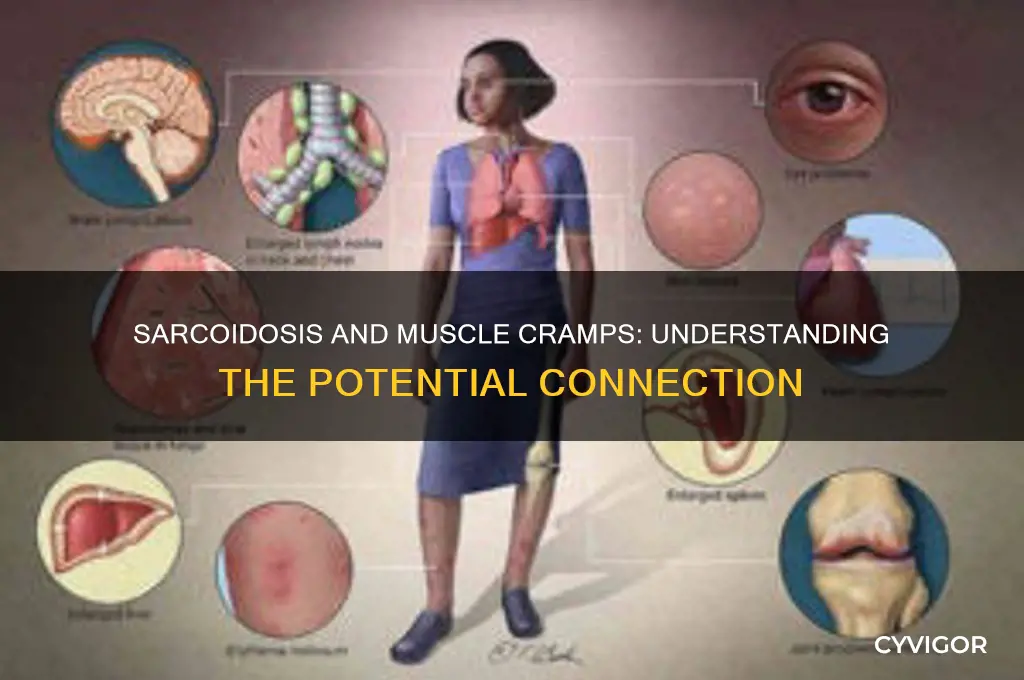 can sarcoidosis cause muscle cramps