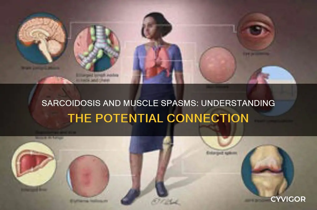 can sarcoidosis cause muscle spasms