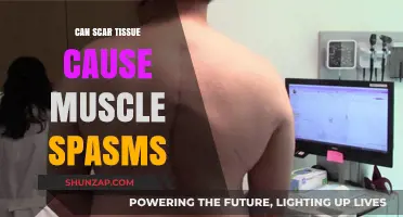 Scar Tissue and Muscle Spasms: Understanding the Connection and Relief