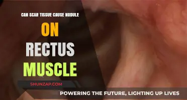 Scar Tissue and Rectus Muscle Nodules: Understanding the Connection