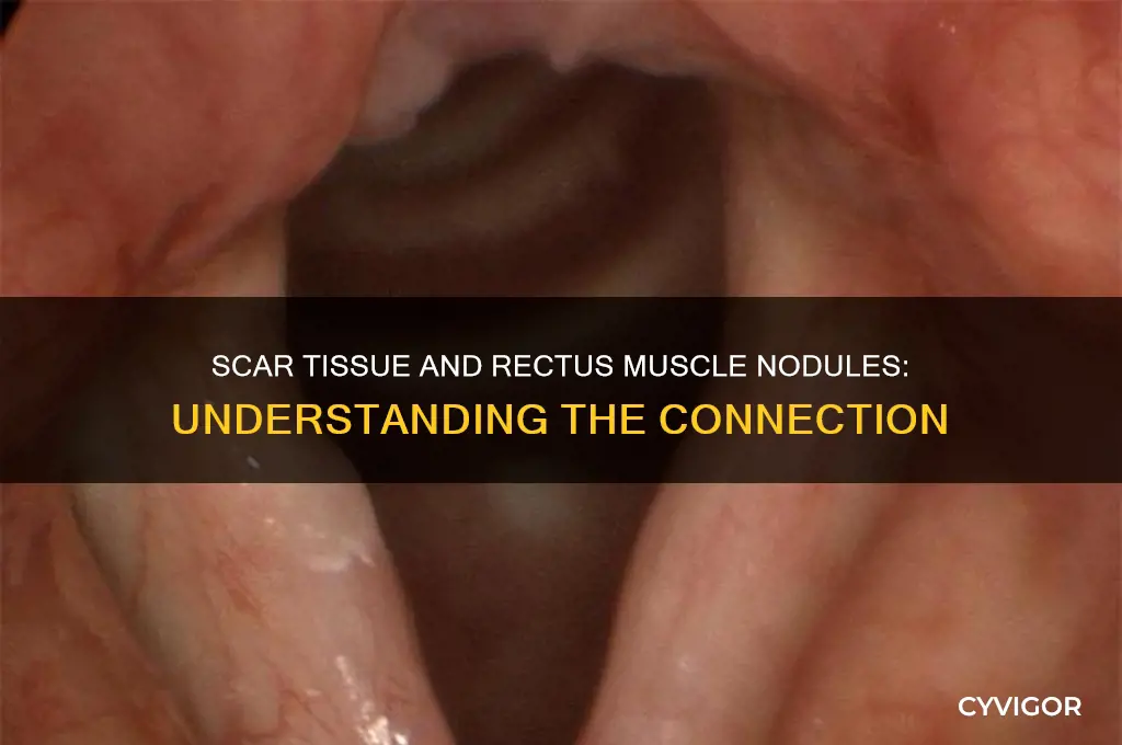 can scar tissue cause nodule on rectus muscle